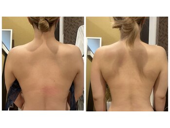 プリマヴェーラ(PRIMAVERA)/背中