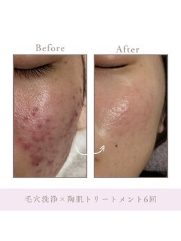 サロン アンジュ(salon.anju)/