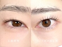 リルフィーユ(Rire Feuille)/4D-flow