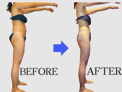 ネオボディ(Neo Body)の写真