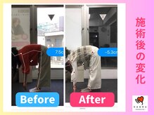 ナオル整体 川越院(NAORU整体)/前屈が楽に出来る【整体/矯正】