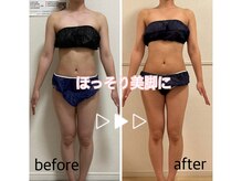 運動も食事制限も一切無し！身体の芯から温めて痩せるが叶う♪