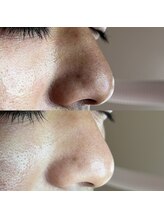 シャイニー(SHINY)/20代男性