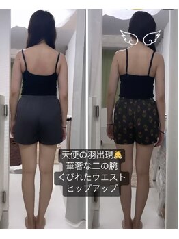 ブルーミングデイズ(blooming days)/ビフォーアフター