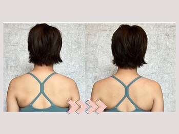 サリー(Sally)/辛い首肩こり解消して小顔にも