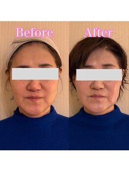 ヨウキ(YOKI)/ハリ・ツヤ感もアップ♪