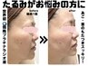 【40・50代のたるみケア】むくみ・小顔・フェイスラインが気になる方