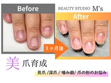 もう手を隠さない！！美爪育成！お爪のお悩みご相談ください(^^)