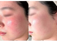 ウォナ(WONA)/【お客様症例】