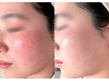 ウォナ(WONA)/【お客様症例】