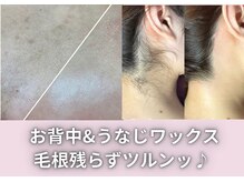 自己処理できない部位はプロにお任せください♪