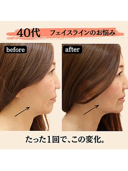 モガミヤ(MOGAMIYA)の写真/県立大学駅から徒歩20秒で通いやすい、静かに整える美容鍼サロン。
