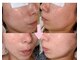 ルイーズ(Louise)の写真/【トラブル・悩み肌ケア×専門知識】個々が持つお肌トラブルに合わせた本格ケアを提案◎