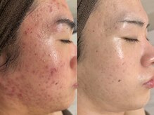 ホリホックの雰囲気（肌状態に合わせたオーダーメイド施術でお悩みを改善します）