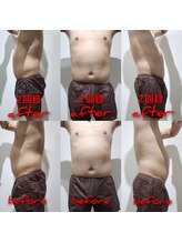 ラクト サロン(RAKT salon)/最新の脂肪冷却　メンズ２回目