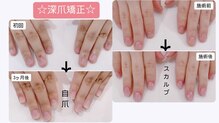 フェリーチェスト(felichest)