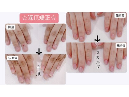 フェリーチェスト(felichest)の写真