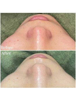 ちらちゅら/クリスティーナ