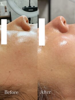 シャルム エスボーテ(charme Esbeaute)/健康な肌に育てる本当の肌育