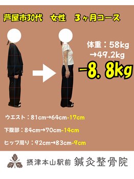 摂津本山駅前鍼灸整骨院/30代女性