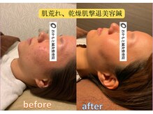 おかもと鍼灸整骨院