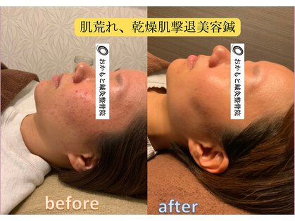 おかもと鍼灸整骨院の写真