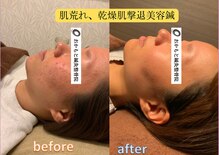 おかもと鍼灸整骨院