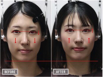 さつま骨格矯正 表参道青山院/歪み小顔矯正＋骨盤矯正