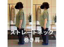 カワル整体 長嶺院/ストレートネック・巻き肩