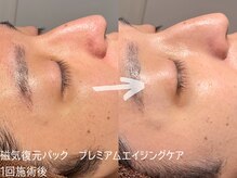 ルーナジェーナ(Luna llena)/池袋　エステ　ルーナジェーナ