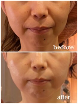 アルコイリス(Arco iris)/大事なのは、見た目年齢では!?