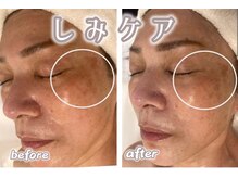 サロンデュヒャーク 志木駅前店(salon du ひゃーく)/お肌のお悩み解決に自信アリ！