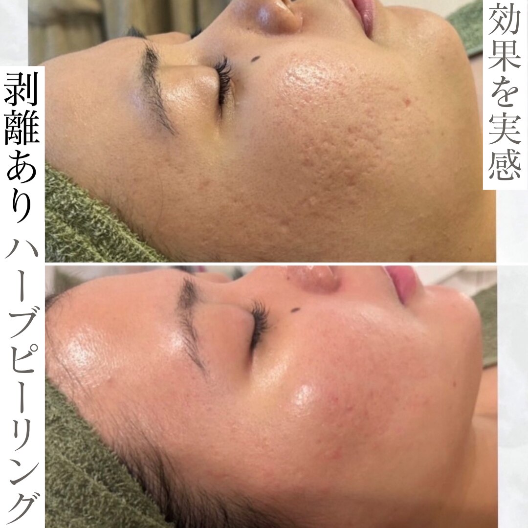 ビューティービューティー(beauty×beauty)｜ホットペッパービューティー