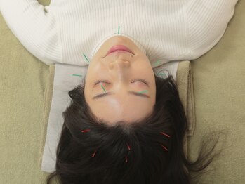 チャンス 西院(chance)の写真/お客様の93%が女性♪美容鍼で食いしばり/顔の左右差/エラ張り改善!女性特有のお悩みも★小顔も同時に叶う！