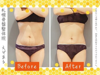 エゾマル(Ezo-maru)/【施術例】ビフォーアフター