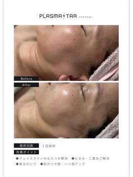 エイト アイ(8 eye)/シミシワたるみを一気にケア！