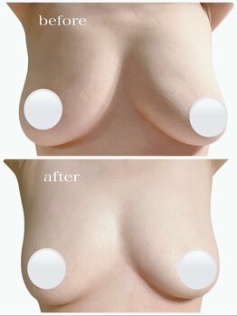 カレント(current)/バストアップ美乳/育乳ケア