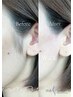 初回☆ 【つるつるたまご肌】フェイス　WAX(ma remove)　￥8900