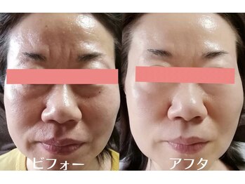サロンドミジュ(Salon de 美jyu)/プラチナ肌質改善