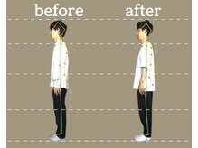 高座渋谷ポポの木整骨院/【圧倒的な結果がでる猫背矯正】