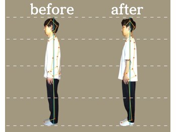 高座渋谷ポポの木整骨院/【圧倒的な結果がでる猫背矯正】