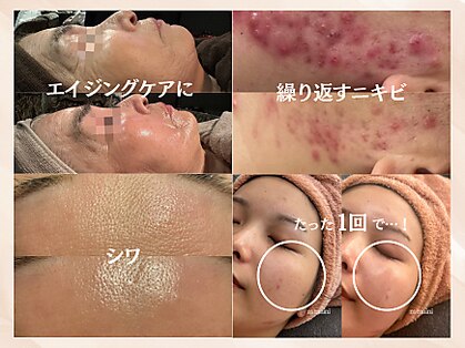 ムーマイニー(m maini)の写真