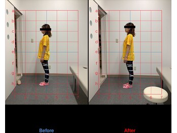 リード整骨院(LEAD整骨院)/O脚X脚にお困りの方。