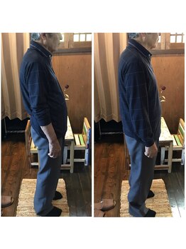 あすから.カイロプラクティック 石芝院/前後の歪みもまっすぐに