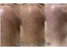 ネイルサロン きらら 藤沢本店の雰囲気（SNSで話題☆いちご鼻・黒ずみ・ザラつき消える!毛穴悩みに特化!!）