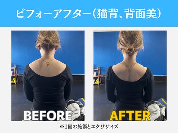 キャリッジスポーツ 盛岡(Carriage Sports)/ビフォーアフター[猫背、背面美]