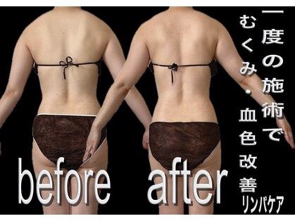 スプーンサロン(SPOON SALON)の写真