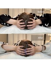 小顔矯正&美容整体サロン　Still U 渋谷/3回の施術効果♪