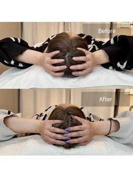 小顔矯正&美容整体サロン Still U 渋谷/3回の施術効果♪