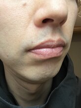 ナノハナ/鹿沼市全身脱毛の美容室ナノハナ